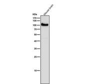 All lanes use the USP5 antibody at 1:1K dilution for 1 hour at room temperature. Predicted molecular weight ~96 kDa.