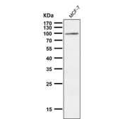 Western blot analysis of USP5 expression in MCF-7 cell lysate using USP5 antibody. Predicted molecular weight ~96 kDa.
