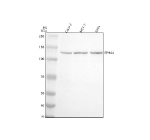 Western blot analysis of EPHA4 using anti-EPHA4 antibody. Electrophoresis was performed on a 8% SDS-PAGE gel at 80V (Stacking gel) / 120V (Resolving gel) for 2 hours. Lane 1: human Caco-2 whole cell lysates, Lane 2: human MCF-7 whole cell lysates, Lane 3: human SIHA whole cell lysates. After electrophoresis, proteins were transferred to a nitrocellulose membrane at 150 mA for 50-90 minutes. Blocked the membrane with 5% non-fat milk/TBS for 1.5 hour at RT. The membrane was incubated with rabbit anti-EPHA4 antibody at 0.5 ug/ml overnight at 4oC, then washed with TBS-0.1%Tween 3 times with 5 minutes each and probed with a goat anti-rabbit IgG-HRP secondary antibody at a dilution of 1:5000 for 1.5 hour at RT. The signal was developed using an ECL Plus Western Blotting Substrate. EPHA4 (~110 kDa predicted) was detected at ~120-130 kDa in Caco-2, MCF-7, and SiHa lysates, consistent with the known upward shift of mature, N-glycosylated EphA4 on SDS-PAGE.