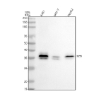 Western blot analysis of SCD1 using anti-SCD1 antibody. Lane 1: human whole cell lysates, Lane 2: human MCF-7 whole cell lysates, Lane 3: human HepG2 whole cell lysates. After electrophoresis, proteins were transferred to a nitrocellulose membrane at 150 mA for 50-90 minutes. Blocked the membrane with 5% non-fat milk/TBS for 1.5 hour at RT. The membrane was incubated with rabbit anti-SCD antibody at 0.5 ug/ml overnight at 4oC, then washed with TBS-0.1%Tween 3 times with 5 minutes each and probed with a goat anti-rabbit IgG-HRP secondary antibody at a dilution of 1:5000 for 1.5 hour at RT. The signal was developed using enhanced chemiluminescent. SCD1 (~41 kDa predicted) was detected as a 36-38 kDa doublet, consistent with the known anomalous migration and phosphorylation-dependent mobility of this endoplasmic reticulum membrane enzyme.