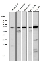 All lanes use the CHAT antibody at 1:2K dilution for 1 hour at room temperature. Predicted molecular weight ~74 kDa.