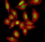 Immunofluorescent staining of GIPC3 using anti-GIPC3 antibody (green) and anti-Beta Tubulin antibody (red). GIPC3 was detected in immunocytochemical section of SiHa cell. Enzyme antigen retrieval was performed using IHC enzyme antigen retrieval reagent for 15 mins. The cells were blocked with 10% goat serum. And then incubated with 5 ug/ml rabbit anti-GIPC3 antibody and mouse anti-Beta Tubulin antibody overnight at 4oC. DyLight 488 Conjugated Goat Anti-Rabbit IgG and DyLight 594 Conjugated Goat Anti-Mouse IgG were used as secondary antibody at 1:500 dilution and incubated for 30 minutes at 37oC. Visualize using a fluorescence microscope and filter sets appropriate for the label used.