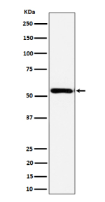 Western blot analysis of AER61 expression in human Caco 2 cell lysate using EOGT antibody. EOGT (~62 kDa predicted) was detected as a strong band at ~52 kDa, consistent with the predominant processed isoform reported for the active enzyme following post-translational maturation in the ER.