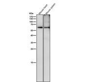All lanes use the Phospho-CRMP2 (Thr514) antibody at 1:6000 dilution for 1 hour at room temperature. Phospho-CRMP2 (~62 kDa predicted) was detected as a major band at ~63-65 kDa, consistent with phosphorylation at GSK3Î²/CDK5-regulated residues Thr509, Thr514, and Ser522, which slightly retard electrophoretic mobility relative to total CRMP2.