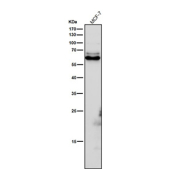 All lanes use the Phospho-CRMP2 (Thr514) antibody at 1:6000 dilution for 1 hour at room temperature. Phospho-CRMP2 (~62 kDa predicted) was detected as a major band at ~63-65 kDa, consistent with phosphorylation at GSK3Î²/CDK5-regulated residues Thr509, Thr514, and Ser522, which slightly retard electrophoretic mobility relative to total CRMP2.