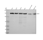 Western blot analysis of SETBP1 using anti-SETBP1 antibody. Electrophoresis was performed on a 8% SDS-PAGE gel at 80V (Stacking gel) / 120V (Resolving gel) for 2 hours. Lane 1: human Hela whole cell lysates, Lane 2: human U251 whole cell lysates, Lane 3: human Hacat whole cell lysates, Lane 4: human RT4 whole cell lysates, Lane 5: mouse brain tissue lysates, Lane 6: mouse Neuro-2a tissue lysates. After electrophoresis, proteins were transferred to a nitrocellulose membrane at 150 mA for 50-90 minutes. Blocked the membrane with 5% non-fat milk/TBS for 1.5 hour at RT. The membrane was incubated with rabbit anti-SETBP1 antibody at 0.5 ug/ml overnight at 4oC, then washed with TBS-0.1%Tween 3 times with 5 minutes each and probed with a goat anti-rabbit IgG-HRP secondary antibody at a dilution of 1:5000 for 1.5 hour at RT. The signal was developed using an ECL Plus Western Blotting Substrate. SETBP1 (~170 kDa predicted) was detected as a single band at 145-150 kDa, consistent with the known anomalous migration of this acidic, intrinsically disordered nuclear adaptor protein.