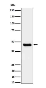Western blot analysis of CABP expression in U-87 MG cell lysate using CABP1 antibody. Predicted molecular weight ~40 kDa.