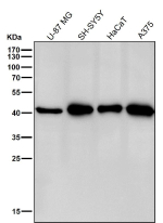 All lanes use the CABP1 antibody at 1:3K dilution for 1 hour at room temperature. Predicted molecular weight ~40 kDa.