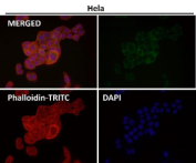 Immunofluorescent analysis using the CABP1 antibody (green) at 1:50 dilution.