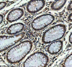 Immunohistochemical staining of ITGB7 using anti-ITGB7 antibody. ITGB7 was detected in a paraffin-embedded section of human colon tissue. Heat mediated antigen retrieval was performed in EDTA buffer (pH 8.0, epitope retrieval solution). The tissue section was blocked with 10% goat serum. The tissue section was then incubated with 1:50 rabbit anti-ITGB7 antibody overnight at 4oC. Peroxidase Conjugated Goat Anti-rabbit IgG was used as secondary antibody and incubated for 30 minutes at 37oC. The tissue section was developed using an HRP secondary and DAB substrate.
