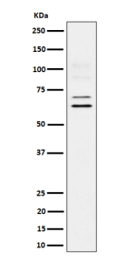 Western blot analysis of BIN1 expression in human U87-MG cell lysate. BIN1 (~65 kDa predicted) was detected as multiple bands at ~65 and ~70 kDa, with faint higher species near ~100 kDa, consistent with known tissue-specific splice variants and post-translationally modified BIN1 isoforms.