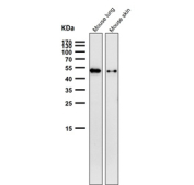 All lanes use the Phospho-Vimentin (Ser39) antibody at 1:1000 dilution for 1 hour at room temperature. Predicted molecular weight ~53-58 kDa.