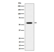 Western blot analysis of Phospho-Vimentin (S39) expression in HeLa treated with Calyculin A cell lysate using Phospho-Vimentin (Ser39) antibody. Predicted molecular weight ~53-58 kDa.