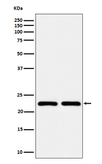 Western blot analysis of RAB22A expression in (1) MCF-7 cell lysate; (2) BxPC-3 cell lysate using RAB22A antibody. Predicted molecular weight ~22 kDa.