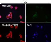 Immunofluorescent analysis using the RAB22A antibody at 1:50 dilution.