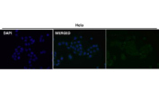 Immunofluorescent analysis using the RAB22A antibody at 1:150 dilution.