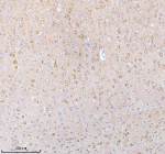 Immunohistochemical staining of STXBP6 using anti-STXBP6 antibody. STXBP6 was detected in a paraffin-embedded section of rat brain tissue. Heat mediated antigen retrieval was performed in EDTA buffer (pH 8.0, epitope retrieval solution). The tissue section was blocked with 10% goat serum. The tissue section was then incubated with 2 ug/ml rabbit anti-STXBP6 antibody overnight at 4oC. Peroxidase Conjugated Goat Anti-rabbit IgG was used as secondary antibody and incubated for 30 minutes at 37oC. The tissue section was developed using an HRP secondary and DAB substrate.