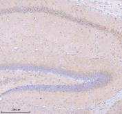 Immunohistochemical staining of STXBP6 using anti-STXBP6 antibody. STXBP6 was detected in a paraffin-embedded section of mouse brain tissue. Heat mediated antigen retrieval was performed in EDTA buffer (pH 8.0, epitope retrieval solution). The tissue section was blocked with 10% goat serum. The tissue section was then incubated with 2 ug/ml rabbit anti-STXBP6 antibody overnight at 4oC. Peroxidase Conjugated Goat Anti-rabbit IgG was used as secondary antibody and incubated for 30 minutes at 37oC. The tissue section was developed using an HRP secondary and DAB substrate.