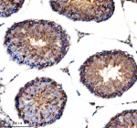 Immunohistochemical staining of NDUF-S2 using anti-NDUF-S2 antibody. NDUF-S2 was detected in a paraffin-embedded section of rat testis tissue. Heat mediated antigen retrieval was performed in EDTA buffer (pH 8.0, epitope retrieval solution). The tissue section was blocked with 10% goat serum. The tissue section was then incubated with 1:50 rabbit anti-NDUF-S2 antibody overnight at 4oC. Peroxidase Conjugated Goat Anti-rabbit IgG was used as secondary antibody and incubated for 30 minutes at 37oC. The tissue section was developed using an HRP secondary and DAB substrate.