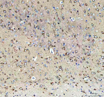 Immunohistochemical staining of SEZ6L2 using anti-SEZ6L2 antibody. SEZ6L2 was detected in a paraffin-embedded section of rat brain tissue. Heat mediated antigen retrieval was performed in EDTA buffer (pH 8.0, epitope retrieval solution). The tissue section was blocked with 10% goat serum. The tissue section was then incubated with 2 ug/ml rabbit anti-SEZ6L2 antibody overnight at 4oC. Peroxidase Conjugated Goat Anti-rabbit IgG was used as secondary antibody and incubated for 30 minutes at 37oC. The tissue section was developed using an HRP secondary and DAB substrate.