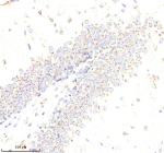 Immunohistochemical staining of ABR using anti-ABR antibody. ABR was detected in a paraffin-embedded section of rat brain tissue. Heat mediated antigen retrieval was performed in EDTA buffer (pH 8.0, epitope retrieval solution). The tissue section was blocked with 10% goat serum. The tissue section was then incubated with 2 ug/ml rabbit anti-ABR antibody overnight at 4oC. Peroxidase Conjugated Goat Anti-rabbit IgG was used as secondary antibody and incubated for 30 minutes at 37oC. The tissue section was developed using an HRP secondary and DAB substrate.