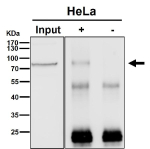 Immunoprecipitation analysis using the antibody at 1:50 dilution. Western blot probed with anti-BRAT1 shows a major band at ~75 kDa, lower than the predicted ~88 kDa, consistent with the known anomalous migration of BRAT1 due to its compact structure and partial N-terminal processing.