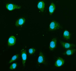 Immunofluorescent staining of MAP2K1 using anti-MAP2K1 antibody (green). MAP2K1 was detected in an immunocytochemical section of TPC1 cells. Enzyme antigen retrieval was performed using IHC enzyme antigen retrieval reagent for 15 mins. The cells were blocked with 10% goat serum. And then incubated with 5 ug/ml rabbit anti-MAP2K1 antibody overnight at 4oC. DyLight 488 Conjugated Goat Anti-Rabbit IgG was used as secondary antibody at 1:500 dilution and incubated for 30 minutes at 37oC. The section was counterstained with DAPI nuclear stain (blue). Visualize using a fluorescence microscope and filter sets appropriate for the label used.