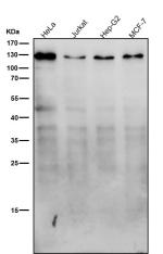 All lanes use the TMEM67 antibody at 1:3K dilution for 1 hour at room temperature. Western blot probed with anti-TMEM67 shows a major band just below the 130 kDa marker, higher than the predicted ~111 kDa, consistent with the mature, N-glycosylated form of the TMEM67 ciliary membrane protein.