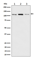 Western blot analysis of Meckelin/TMEM67 expression in (1) human MCF7 cell lysate; (2) mouse RAW 264.7 cell lysate; (3) rat C6 cell lysate using TMEM67 antibody. Expected molecular weight ~111 kDa, corresponding the the unglycosylated form of the protein.