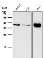 All lanes use the CXCR6 antibody at 1:1000 dilution for 1 hour at room temperature. Predicted molecular weight ~39 kDa.