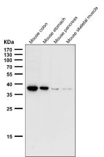 All lanes use the CXCR6 antibody at 1:1000 dilution for 1 hour at room temperature. Predicted molecular weight ~39 kDa.