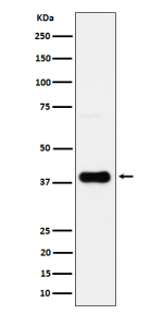 Western blot analysis of CXCR6/CD186 expression in human JAR cell lysate using CXCR6 antibody. Predicted molecular weight ~39 kDa.