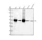 Western blot analysis of TRIP6 using anti-TRIP6 antibody. Electrophoresis was performed on a 10% SDS-PAGE gel at 80V (Stacking gel) / 120V (Resolving gel) for 2 hours. Lane 1: human Hela whole cell lysates, Lane 2: human 293T whole cell lysates, Lane 3: human MCF-7 whole cell lysates, Lane 4: rat testis tissue lysates, Lane 5: mouse testis tissue lysates. After electrophoresis, proteins were transferred to a nitrocellulose membrane at 150 mA for 50-90 minutes. Blocked the membrane with 5% non-fat milk/TBS for 1.5 hour at RT. The membrane was incubated with rabbit anti-TRIP6 antibody at 0.5 ug/ml overnight at 4oC, then washed with TBS-0.1%Tween 3 times with 5 minutes each and probed with a goat anti-rabbit IgG-HRP secondary antibody at a dilution of 1:5000 for 1.5 hour at RT. The signal was developed using an ECL Plus Western Blotting Substrate. A specific band was detected for TRIP6 at approximately 50 kDa. The expected molecular weight of TRIP6 is ~50 kDa.