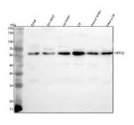 Western blot analysis of NETO2 using anti-NETO2 antibody. Lane 1: human SIHA whole cell lysates, Lane 2: human SH-SY5Y whole cell lysates, Lane 3: rat brain tissue lysates, Lane 4: rat C6 whole cell lysates, Lane 5: mouse brain tissue lysates, Lane 6: mouse Neuro-2a whole cell lysates. After electrophoresis, proteins were transferred to a nitrocellulose membrane at 150 mA for 50-90 minutes. Blocked the membrane with 5% non-fat milk/TBS for 1.5 hour at RT. The membrane was incubated with rabbit anti-NETO2 antibody at 0.5 ug/ml overnight at 4oC, then washed with TBS-0.1%Tween 3 times with 5 minutes each and probed with a goat anti-rabbit IgG-HRP secondary antibody at a dilution of 1:5000 for 1.5 hour at RT. The signal was developed using enhanced chemiluminescent. The expected molecular weight of NETO2 is ~59 kDa.