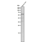 Mouse skin tissue lysate western blot tested with the NR2C2 antibody at 1:4000 dilution for 1 hour at room temperature. Predicted molecular weight: 65-67 kDa (two isoforms).