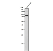 All lanes use the antibody at 1:2000 dilution for 1 hour at room temperature. Western blot analysis of IL12B using anti-IL12B antibody. A strong band is observed at ~75-80 kDa, corresponding to the disulfide-linked homodimer, consistent with reports that the subunit forms stable dimers that migrate above the predicted 37 kDa monomeric size.