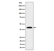 Western blot analysis of IL12B in recombinant human IL12B protein cell lysate. Expected molecular weight ~37-40 kDa.