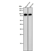 All lanes use the antibody at 1:2000 dilution for 1 hour at room temperature. Western blot analysis of IL12B using anti-IL12B antibody. A strong band is observed at ~75-80 kDa, corresponding to the disulfide-linked homodimer, consistent with reports that the subunit forms stable dimers that migrate above the predicted 37 kDa monomeric size.