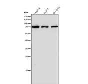 All lanes use the antibody at 1:2000 dilution for 1 hour at room temperature. Western blot analysis of IL12B using anti-IL12B antibody. A strong band is observed at ~75-80 kDa, corresponding to the disulfide-linked homodimer, consistent with reports that the subunit forms stable dimers that migrate above the predicted 37 kDa monomeric size.
