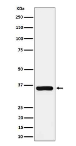 Western blot analysis of Gamma glutamyl hydrolase expression in human MCF7 cell lysate using GGH antibody. Expected molecular weight ~36 kDa but additional bands may be observed due to glycosylation.