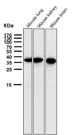 All lanes use the GGH antibody at 1:1000 dilution for 1 hour at room temperature. Expected molecular weight ~36 kDa but additional bands may be observed due to glycosylation.
