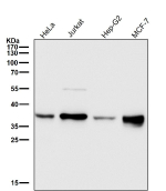 All lanes use the GGH antibody at 1:1000 dilution for 1 hour at room temperature. Expected molecular weight ~36 kDa but additional bands may be observed due to glycosylation.