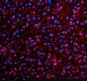Immunofluorescent staining of NMNAT1 using anti-NMNAT1 antibody (red). NMNAT1 was detected in a paraffin-embedded section of rat brain tissue. Heat mediated antigen retrieval was performed in EDTA buffer (pH 8.0, epitope retrieval solution). The tissue section was blocked with 10% goat serum. The tissue section was then incubated with 5 ug/ml rabbit anti-NMNAT1 antibody overnight at 4oC. Cy3 Conjugated Goat Anti-Rabbit IgG was used as secondary antibody at 1:500 dilution and incubated for 30 minutes at 37oC. The section was counterstained with DAPI nuclear stain (blue). Visualize using a fluorescence microscope and filter sets appropriate for the label used.