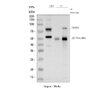 Immunoprecipitating TMPO in Hela whole cell lysate. Western blot analysis of TMPO using anti-TMPO antibody. Lane 1: Hela whole cell lysates (30ug), Lane 2: Rabbit control IgG instead of anti-TMPO antibody in Hela whole cell lysate, Lane 3: anti-TMPO antibody (2ug) + Hela whole cell lysate (500ug). After electrophoresis, proteins were transferred to a membrane. Then the membrane was incubated with rabbit anti-TMPO antibody at a dilution of 0.5 ug/ml and probed with a goat anti-rabbit IgG-HRP secondary antibody. The signal is developed using ECL Plus Western Blotting Substrate. A specific band was detected for TMPO at approximately 75 kDa. The expected molecular weight of TMPO is at 75 kDa (alpha form).
