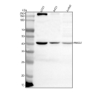 Western blot analysis of PHKG1 using anti-PHKG1 antibody. Lane 1: human U251 whole cell lysates, Lane 2: human whole cell lysates, Lane 3: human Jurkat whole cell lysates. After electrophoresis, proteins were transferred to a nitrocellulose membrane at 150 mA for 50-90 minutes. Blocked the membrane with 5% non-fat milk/TBS for 1.5 hour at RT. The membrane was incubated with rabbit anti-PHKG1 antibody at 0.5 ug/ml overnight at 4oC, then washed with TBS-0.1%Tween 3 times with 5 minutes each and probed with a goat anti-rabbit IgG-HRP secondary antibody at a dilution of 1:5000 for 1.5 hour at RT. The signal was developed using enhanced chemiluminescent. A predominant band is observed at ~40 kDa, slightly below the ~45 kDa calculated mass, consistent with reported faster migration and proteolytic trimming of the catalytic gamma subunit in cell lysates.