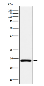 Western blot analysis of DUT expression in Ramos cell lysate using DUT antibody. Bands corresponding to the mitochondrial (~24-27 kDa) and the shorter nuclear/cytosolic (~18-21 kDa) isoforms can be detected; the ~18 kDa isoform can appear as a doublet consistent with modification- and processing-dependent mobility.
