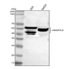 Western blot analysis of ANGPTL4 using anti-ANGPTL4 antibody. Lane 1: human 293T whole cell lysates, Lane 2: human SW620 whole cell lysates. After electrophoresis, proteins were transferred to a nitrocellulose membrane at 150 mA for 50-90 minutes. Blocked the membrane with 5% non-fat milk/TBS for 1.5 hour at RT. The membrane was incubated with rabbit anti-ANGPTL4 antibody at 0.5 ug/ml overnight at 4oC, then washed with TBS-0.1%Tween 3 times with 5 minutes each and probed with a goat anti-rabbit IgG-HRP secondary antibody at a dilution of 1:5000 for 1.5 hour at RT. The signal was developed using enhanced chemiluminescent. Bands are detected between ~40 and 50 kDa, consistent with reported glycosylated and proteolytically processed forms of the secreted ANGPTL4 protein (predicted 45 kDa).