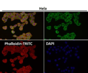 Immunofluorescent analysis using the LAG-3 antibody (green) at 1:50 dilution.