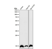 All lanes use the Histone H2B (acetyl K16) antibody at 1:1000 dilution for 1 hour at room temperature. Predicted molecular weight ~15 kDa.
