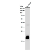 Rat brain tissue lysate tested with CRP antibody at 1:1000 dilution for 1 hour at room temperature. A predominant band is detected at ~17 kDa, consistent with proteolytically processed CRP fragments; other antibodies may detect the ~23-26 kDa monomer under the same conditions.